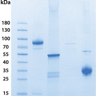 Sds Page Analysis Of Sars Cov Recombinant Proteins Lane S Lane