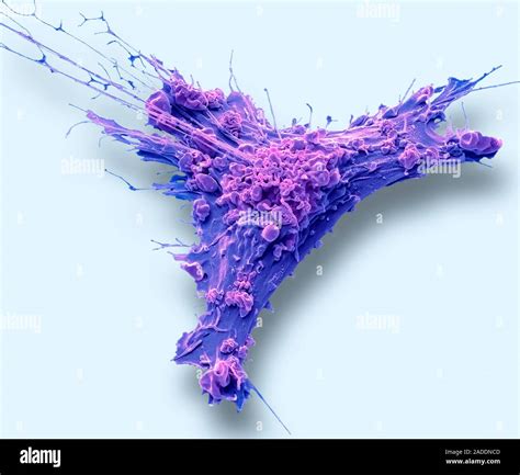 Fibroblast Cell Coloured Scanning Electron Micrograph Of A Mammalian