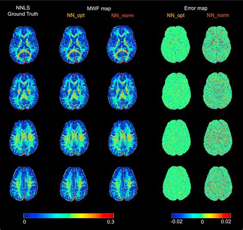 Figure 2 From Myelin Water Imaging Data Analysis In Less Than One