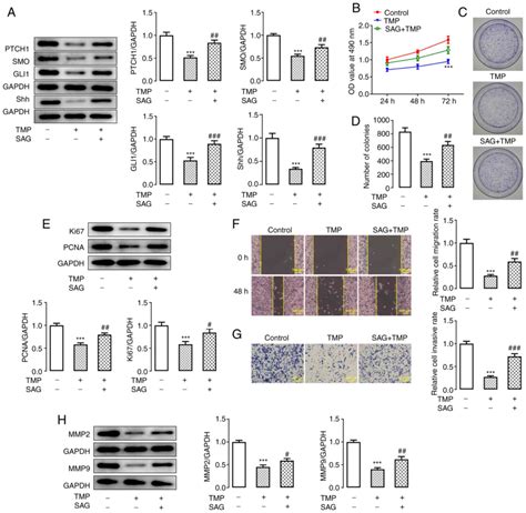 Tetramethylpyrazine Inhibits The Proliferation Invasiveness And