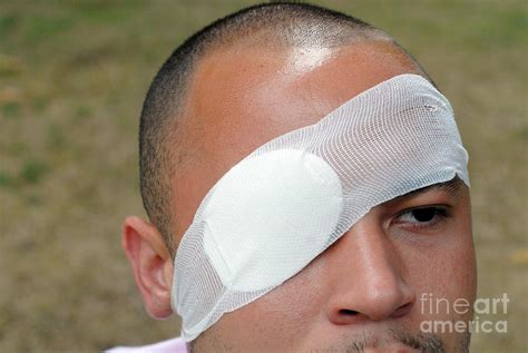 Man Wearing Any Eye Patch Photograph By Medicimage Science Photo Library Pixels