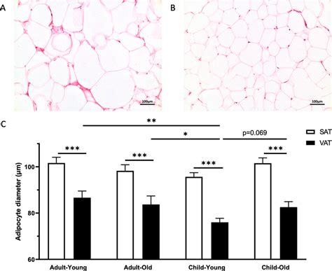 Histologic Measurements Of Adipocyte Size Representative Images Of