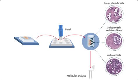 Proteomics Analysis Of Formalin Fixed Paraffin Embedded 42 OFF