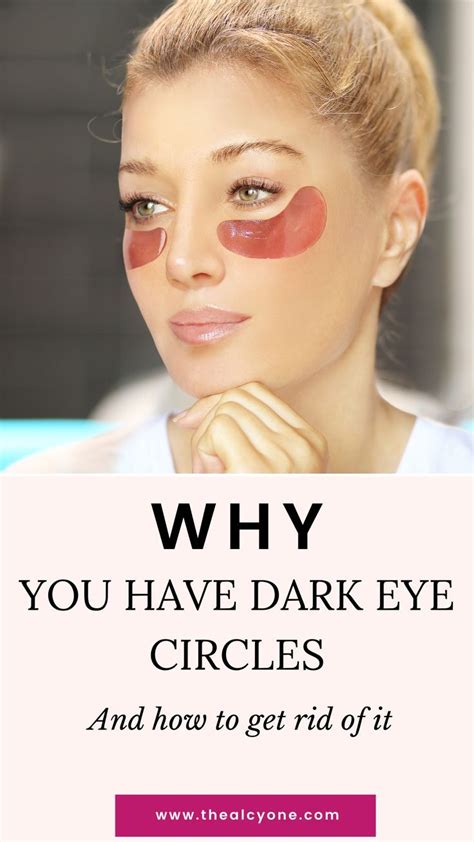 7 Reasons Why You Always Have Dark Circles Under Eyes Dark Circles Under Eyes Dark Circles