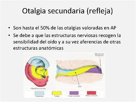 Otalgia Diagnstico Diferencial Marina Alapont Serrano R