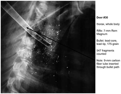 Photos and videos of lead poisoning