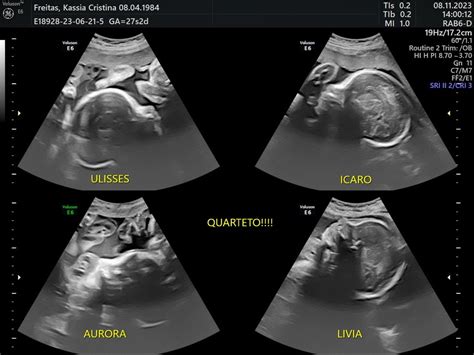 4 Meses De Gestacao - "Quando completei 4 meses de gestação, ele terminou. Fui deixada", diz ...