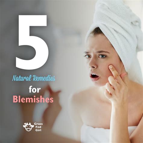 5 Natural Remedies for Blemishes