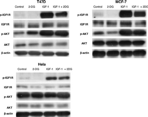 Western Blot Assay Of Igf 1r Signaling Mcf 7 T47d And Hela Cell Download Scientific Diagram