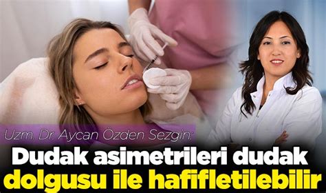 Uzm Dr Sezgin Dudak Asimetrileri Dudak Dolgusu Ile Hafifletilebilir