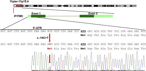 A Single Recurrent Mutation In The 5 UTR Of IFITM5 Causes Osteogenesis