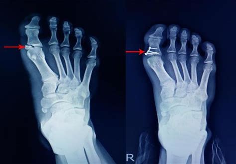 X Ray Foot Stock Photos, Images and Backgrounds for Free Download