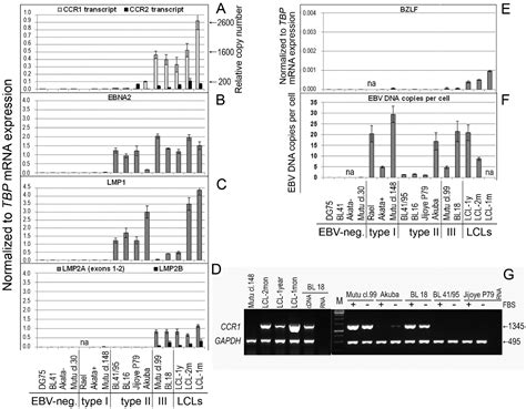 Ijms Free Full Text Expression Of The Chemokine Receptor Ccr1 In