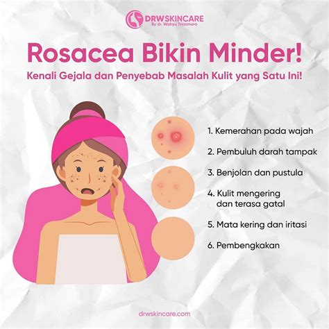 Kenali Gejala Dan Penyebab Masalah Kulit Rosacea