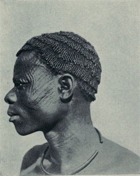 Ichi Marks On An Igbo Person Taken In The Late Ụ́kpụ́rụ́