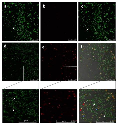 Confocal Images Showing Live Dead Thiazole Orange Propidium Iodide