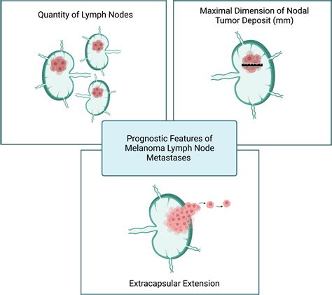 Frontiers Melanoma Lymph Node Metastases Moving Beyond Quantity In Clinical Trial Design And