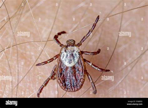 El Portador De La Enfermedad De Lyme Ixodes Garrapata Dermacentor