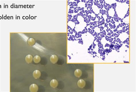 Exam 2 Staphylococcus Flashcards Quizlet