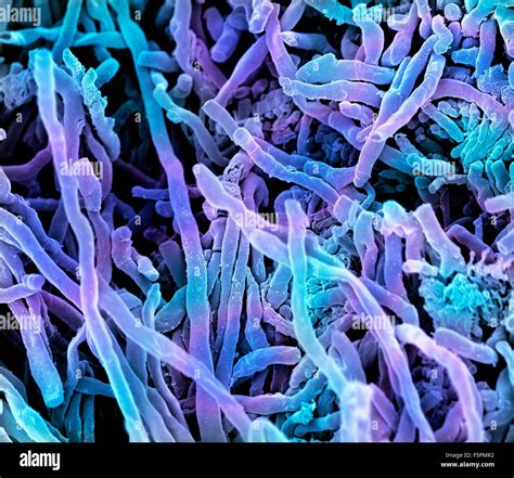 Streptomyces Coelicoflavus Bacteria Coloured Scanning Electron