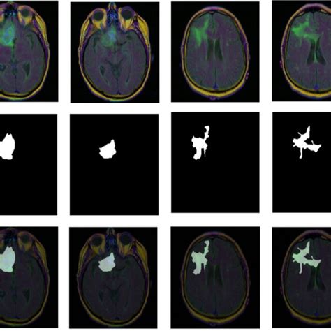 Dataset Visualization MRI Image Above Segmentation Mask In The