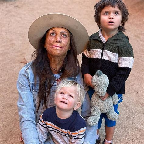 Turia Pitt Recalls The Moment She Found Confronting Images Of Her