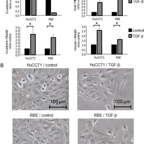 TGF β induced EMT in CCA cells A HuCCT1 and RBE cells were treated