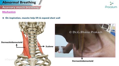 Abnormal Breathing Accessory Muscle Breathing Agonal Apneustic