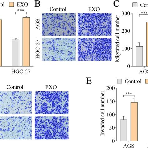 CAF Derived Exosomes Facilitate GC Cell Viability Migration And