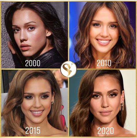 Cosmetic Injectables 🇬🇧 On Instagram “jessica Albas Transformation