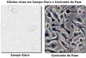 O Microsc Pio De Contraste De Fase O Que Ele E Para Que Ele Serve