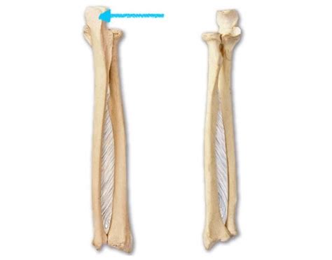 Radius Ulna Boney Landmarks Flashcards Quizlet