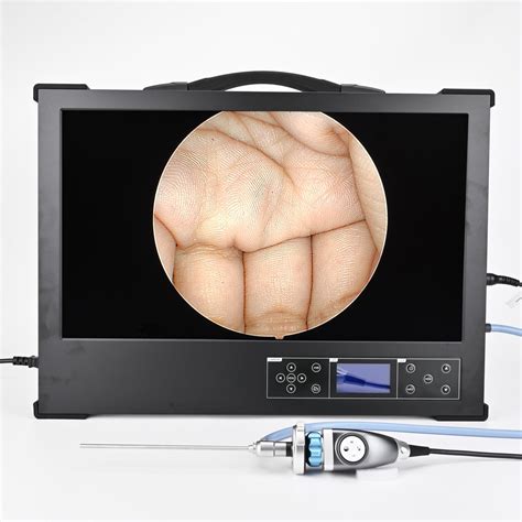 Ce Approved Laparoscopic Camera Full Hd P Usb Recorder China