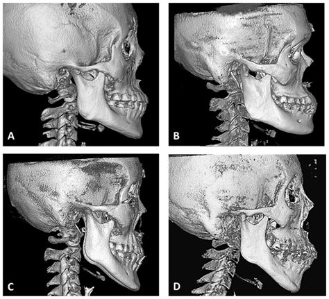 Bioengineering Free Full Text Morphological Study Of The Mandibular