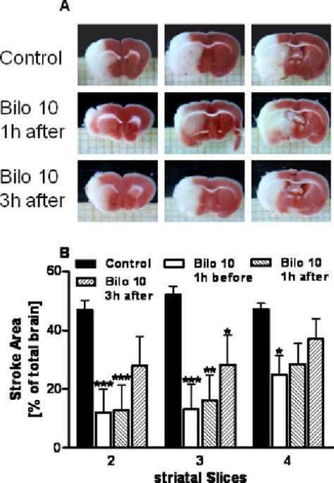 Figure From Neuroprotective Effects Of Bilobalide Are Accompanied By