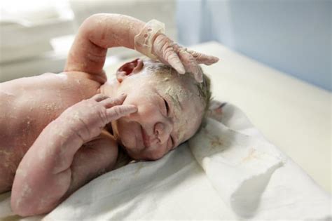 Vernix Caseosa Lapisan Putih Pada Bayi Saat Dilahirkan Hello Sehat