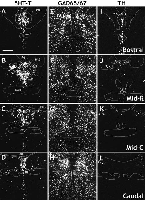 Darkfield Digital Photomicrographs Showing The Distribution Of