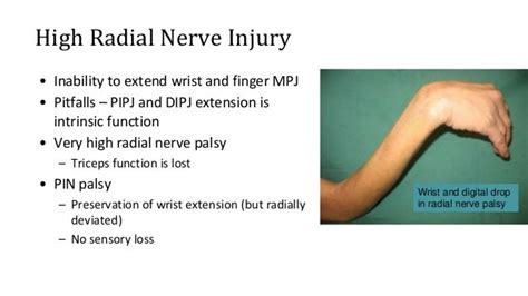 Approach To Hand Conditions