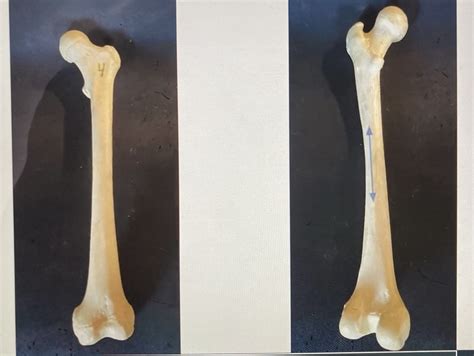 Femur Anterior And Posterior Diagram Quizlet