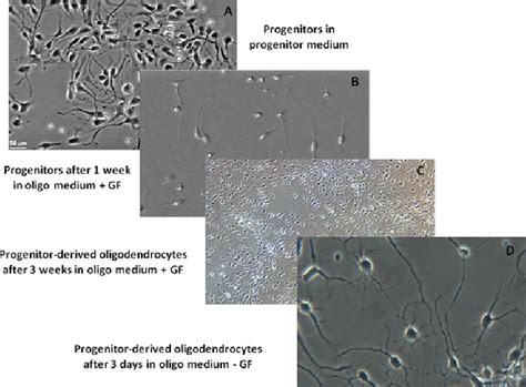 Phase Contrast Microscopy Of A Neural Progenitor Cells Cultured In Download Scientific