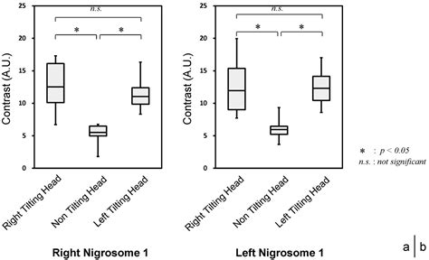 Visualization Of Nigrosome 1 From The Viewpoint Of Anatomic Structure American Journal Of