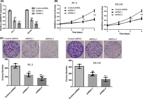 Downregulated Linc Inhibits Prostate Cancer Cell Proliferation