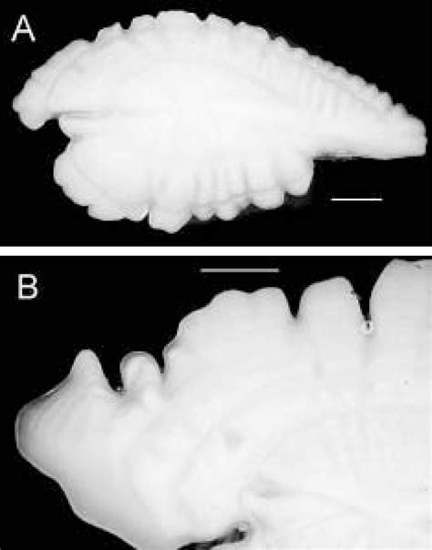 A Whole Otolith From A Cm Fork Length Male Barracouta Estimated