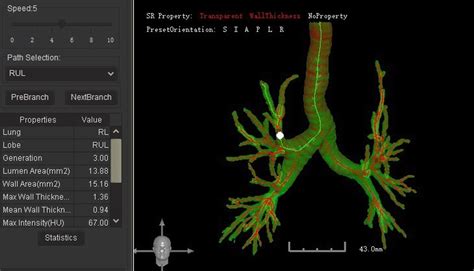 Sex Related Differences In Airway Dimensions A Study Based Health Physics