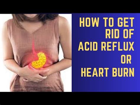 Acid Reflux Or Heart Burn Symptoms Causes Risk Factors How To Get