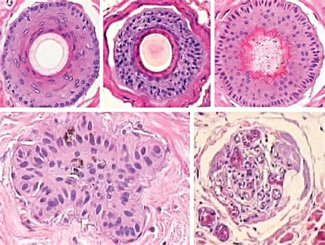 Hair Histology