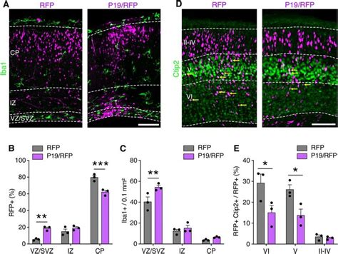 Delayed Migration After P Overexpression Impaired Cortical Layering