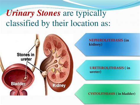 Stones And Tumours Of Kidney Ppt By Smriti Singh