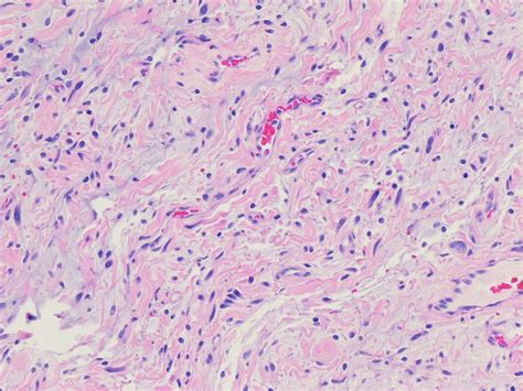 Pathology Outlines