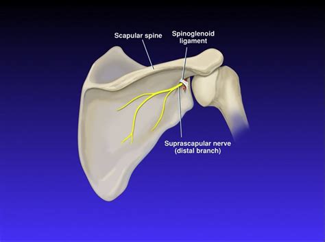 Endoscopic Arthroscopic Decompression Of The Suprascapular Nerve At The